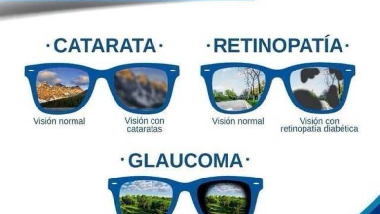 ¿Cómo ve una persona con cataratas, retinopatía o glaucoma?