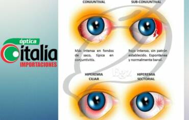 Ojo rojo: ¿cuándo es normal y cuándo hay que consultar?